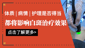 白癜风308激光几天照一次