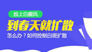 白癜风308激光几天照一次