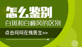 白癜风308激光几天照一次