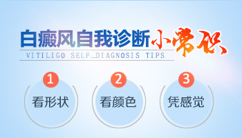 <a href=https://www.learncfml.com/zhengzhuang/ target=_blank class=infotextkey>白癜风症状</a>