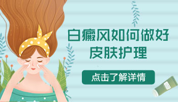 小孩脸上小面积白癜风适合哪种方法治疗