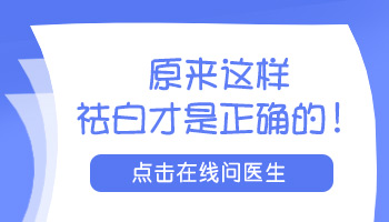 伍德灯下轻度白癜风检查结果图片大全