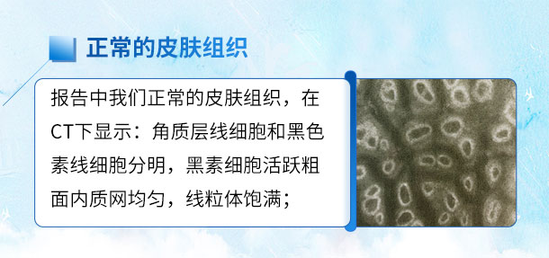 北京医师来啦！！特邀北京白癜风医师——苏有明教授将于4月5日来院会诊