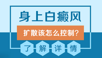 沧州治疗皮肤白癜风推荐哪个医院治疗效果好