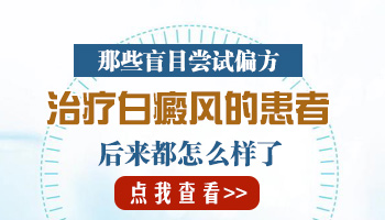 沧州白癜风医院治疗比较好的是哪家