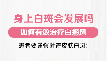 伍德灯检测出初期的白癜风能确诊吗